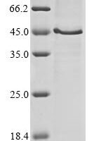 Mouse Hyaluronan and proteoglycan link protein 3 (Hapln3) Recombinant Protein, N-10His/C-Myc, aa 18–359, Mammalian cell - BioCrest Sci