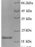 Mouse Interleukin-1 beta (Il1b), partial Recombinant Protein - BioCrest Sci