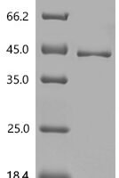 Human Serine protease inhibitor Kazal-type 6 (SPINK6) Recombinant Protein - BioCrest Sci