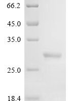 Dermatophagoides pteronyssinus Mite allergen Der p 6 (DERP6) (X4S) Recombinant Protein, N-GST - BioCrest Sci