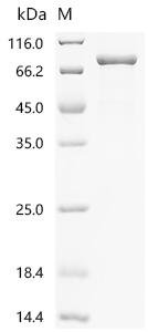 Human Multiple inositol polyphosphate phosphatase 1 (MINPP1) Recombinant Protein, C-GST, Homo sapiens (Human), E.coli, C-terminal GST-tagged, 83.7 kDa, purity >≥ 90% as determined by SDS-PAGE.