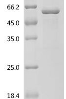 Human UDP-glucuronosyltransferase 3A2 (UGT3A2), partial Recombinant Protein - BioCrest Sci