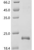 Human papillomavirus 51 Protein E7 (E7) Recombinant Protein - BioCrest Sci