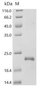 Human papillomavirus 51 Protein E7 (E7) Recombinant Protein, Human papillomavirus 51, E.coli, C-terminal 6xHis-tagged, 18.3 kDa, purity >≥ 95% as determined by SDS-PAGE.