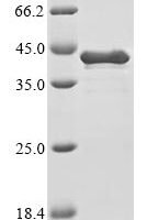 Human Heat shock protein HSP 90-alpha (HSP90AA1), partial Recombinant Protein, C-His - BioCrest Sci