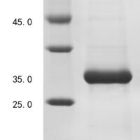 Human Filamin A-interacting protein 1-like (FILIP1L), partial Recombinant Protein - BioCrest Sci