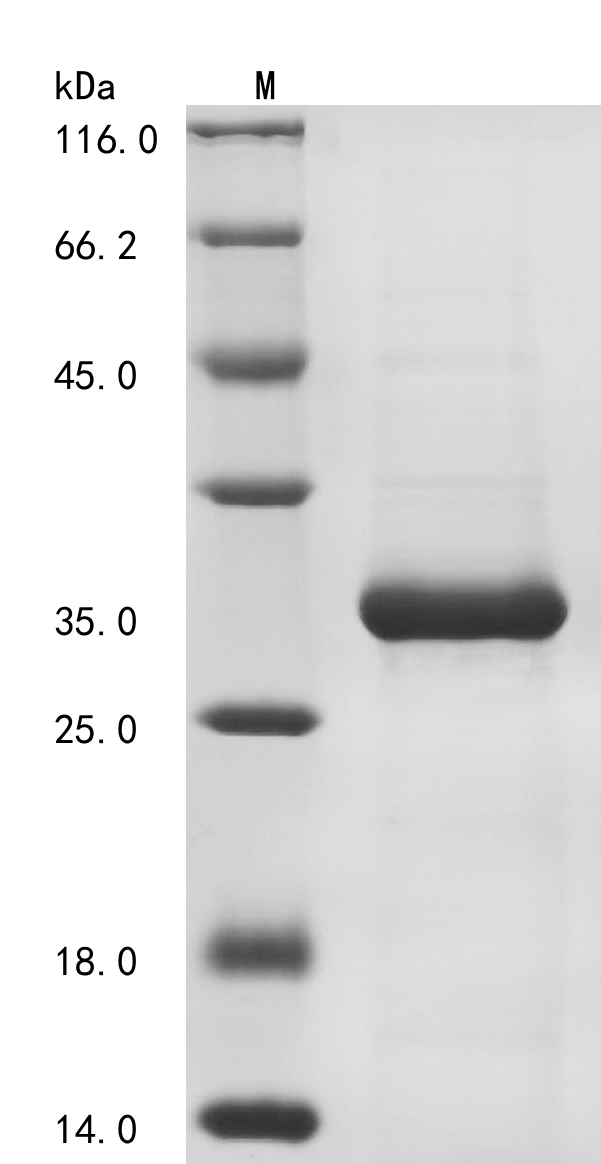 Human Filamin A-interacting protein 1-like (FILIP1L), partial Recombinant Protein, Homo sapiens (Human), E.coli, N-terminal 6xHis-tagged, 27.6 kDa, purity >≥ 85% as determined by SDS-PAGE.