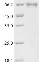 Human NACHT, LRR and PYD domains-containing protein 3 (NLRP3), partial Recombinant Protein, C-His, aa 131–704 - BioCrest Sci