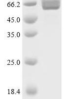Streptococcus pneumoniae Pneumolysin (ply) Recombinant Protein, C-His - BioCrest Sci
