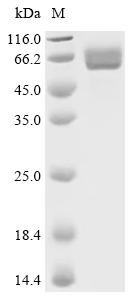Streptococcus pneumoniae Pneumolysin (ply) Recombinant Protein, C-His, Streptococcus pneumoniae (strain ATCC BAA-255 / R6), Yeast, C-terminal 6xHis-tagged, 54.3 kDa, purity >≥ 95% as determined by SDS-PAGE.