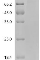 Human Protein O-GlcNAcase (OGA) Recombinant Protein, C-His, aa 1–916, Baculovirus - BioCrest Sci