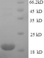 Human Immunoglobulin-like domain-containing receptor 2 (ILDR2), partial Recombinant Protein, N-His - BioCrest Sci