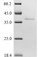Human Kinesin-like protein KIFC2 (KIFC2), partial Recombinant Protein - BioCrest Sci