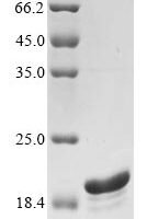 Sheep Serum amyloid A protein (SAA1) Recombinant Protein - BioCrest Sci