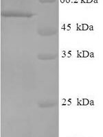 Human Regulator of microtubule dynamics protein 3 (RMDN3) Recombinant Protein - BioCrest Sci