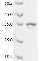 Human Fibroblast growth factor 3 (FGF3) Recombinant Protein - BioCrest Sci