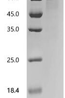 Human Interleukin-22 receptor subunit alpha-2 (IL22RA2) Recombinant Protein - BioCrest Sci