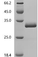 Human Chromogranin-A (CHGA), partial Recombinant Protein, C-10His, aa 19–245 - BioCrest Sci