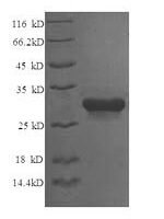Gallus gallus Syntaxin-6 (STX6), partial Recombinant Protein - BioCrest Sci