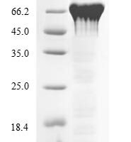 Mouse Peroxisome proliferator-activated receptor gamma (Pparg) Recombinant Protein, N-His-SUMO - BioCrest Sci