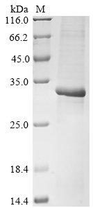 Human Mitochondrial cardiolipin hydrolase (PLD6) Recombinant Protein, N-His, Homo sapiens (Human), E.coli, N-terminal 6xHis-tagged, 31.0 kDa, purity >≥ 85% as determined by SDS-PAGE.