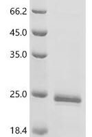 Anopheles gambiae AGAP010489-PA (OBP-4) Recombinant Protein - BioCrest Sci