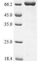Macaca fascicularis Myocilin (MYOC) Recombinant Protein - BioCrest Sci