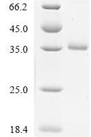 Mouse Protransforming growth factor alpha (Tgfa), partial Recombinant Protein, N-hFc1 - BioCrest Sci