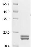 Enterobacter aerogenes Outer membrane protein A (ompA), partial Recombinant Protein - BioCrest Sci