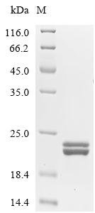 Enterobacter aerogenes Outer membrane protein A (ompA), partial Recombinant Protein, Klebsiella aerogenes (Enterobacter aerogenes), Yeast, N-terminal 10xHis-tagged and C-terminal Myc-tagged, 19.3 kDa, purity >≥ 95% as determined by SDS-PAGE.