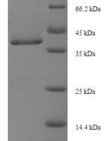 Cynops pyrrhogaster Annexin A5 Recombinant Protein, N-His, aa 1–323, E.coli - BioCrest Sci