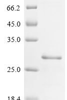 Mouse Heparin-binding growth factor 2 (Fgf2) Recombinant Protein - BioCrest Sci