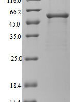Legionella pneumophila subsp. pneumophila Gamma-glutamyl phosphate reductase (proA) Recombinant Protein - BioCrest Sci