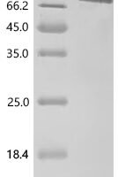 Human Delta-like protein 4 (DLL4), partial Recombinant Protein - BioCrest Sci