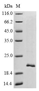 Macaca fascicularis Transthyretin (TTR) Recombinant Protein, Macaca fascicularis (Crab-eating macaque) (Cynomolgus monkey), Mammalian cell, N-terminal 6xHis-Myc-tagged, 17.7 kDa, purity >≥ 90% as determined by SDS-PAGE.