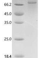 Mouse Semaphorin-4B (Sema4b), partial Recombinant Protein, N-10His/C-Myc - BioCrest Sci
