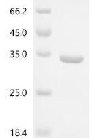 Escherichia coli Esterase ybfF (ybfF) Recombinant Protein - BioCrest Sci