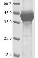 Human Hamartin (TSC1), partial Recombinant Protein - BioCrest Sci
