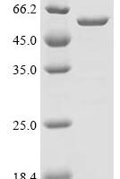 Human Heme oxygenase 1 (HMOX1), partial Recombinant Protein - BioCrest Sci