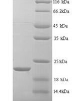 Rat Matrilysin (Mmp7) Recombinant Protein, N-His - BioCrest Sci