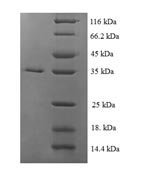 Escherichia coli Plasmid-derived single-stranded DNA-binding protein (ssbF) Recombinant Protein, Escherichia coli (strain K12), E.coli, N-terminal 6xHis-SUMO-tagged, 35.5 kDa, purity >≥ 90% as determined by SDS-PAGE.