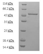 Human Purine nucleoside phosphorylase (PNP) Recombinant Protein - BioCrest Sci
