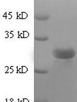 Bovine Surfactant protein C (SFTPC) Recombinant Protein - BioCrest Sci