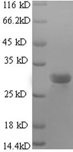 Bovine Surfactant protein C (SFTPC) Recombinant Protein, Bos taurus (Bovine), E.coli, N-terminal GST-tagged, 30.6 kDa, purity >≥ 90% as determined by SDS-PAGE.