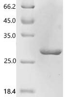 Escherichia coli O6:H1Superoxide dismutase [Fe] (sodB) Recombinant Protein - BioCrest Sci