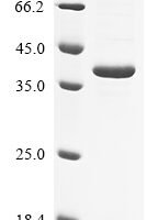 Rat Non-lysosomal glucosylceramidase (Gba2), partial Recombinant Protein - BioCrest Sci
