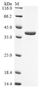 Rat Non-lysosomal glucosylceramidase (Gba2), partial Recombinant Protein, Rattus norvegicus (Rat), E.coli, C-terminal 6xHis-tagged, 42.6 kDa, purity >≥ 85% as determined by SDS-PAGE.