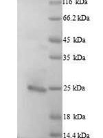 Human Bcl-2-like protein 11 (BCL2L11) Recombinant Protein, N-His, aa 1–198, Yeast - BioCrest Sci