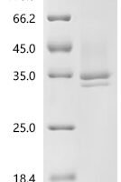 Serratia marcescens Nuclease (nucA) Recombinant Protein - BioCrest Sci