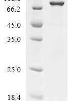Mouse Midkine(Mdk) Recombinant Protein - BioCrest Sci